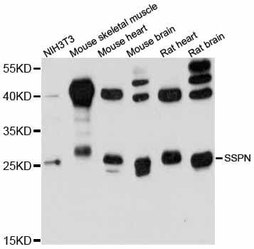 SSPN / Sarcospan Antibody