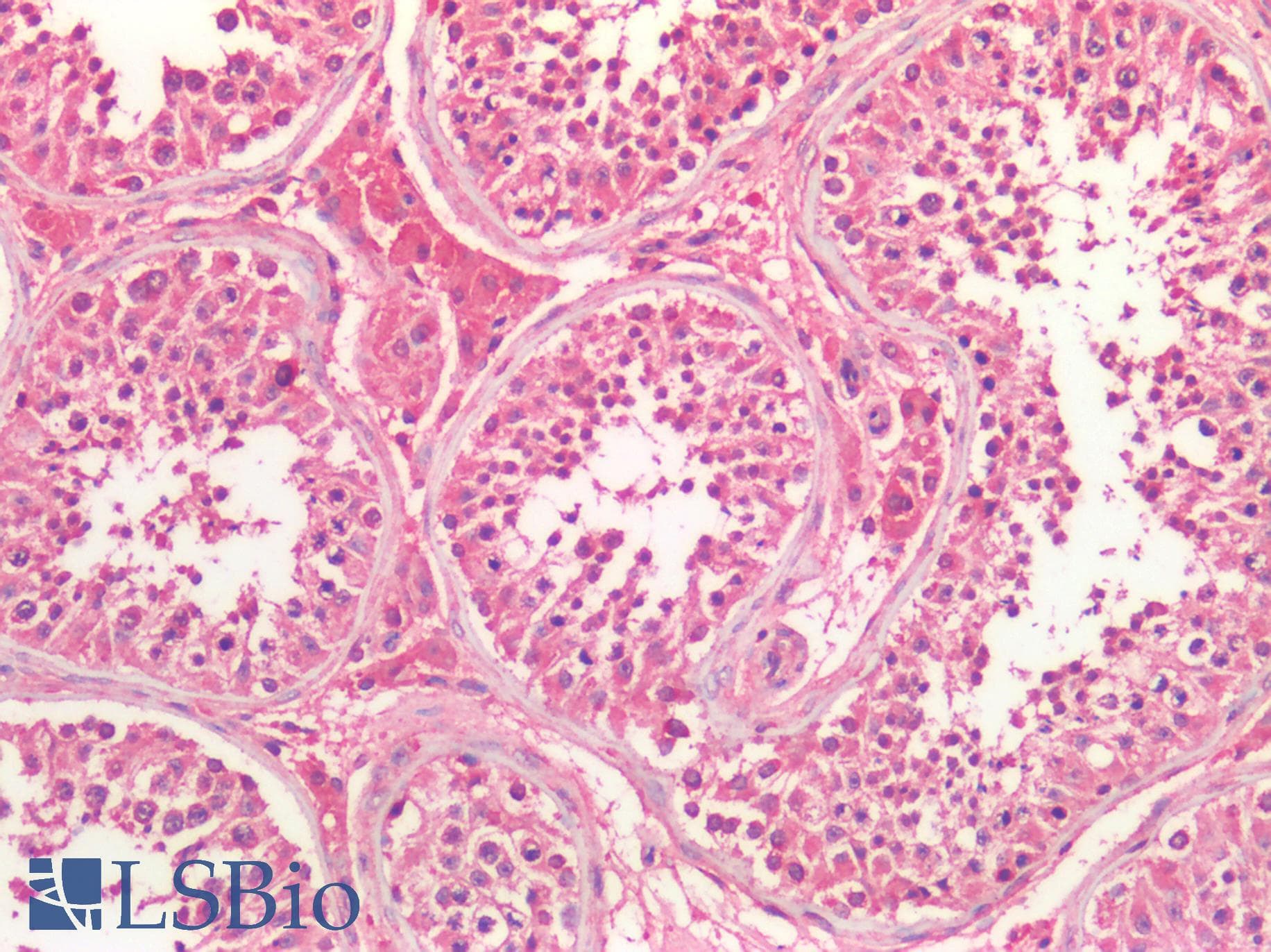 IHC-plus™ GFRA3 Antibody