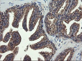 Monoclonal Mouse anti-Human VBP1 Antibody (clone OTI2C2, IHC, WB)