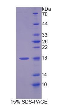 Rat GLOD2 / MCEE Protein (Recombinant His, N-Terminal)