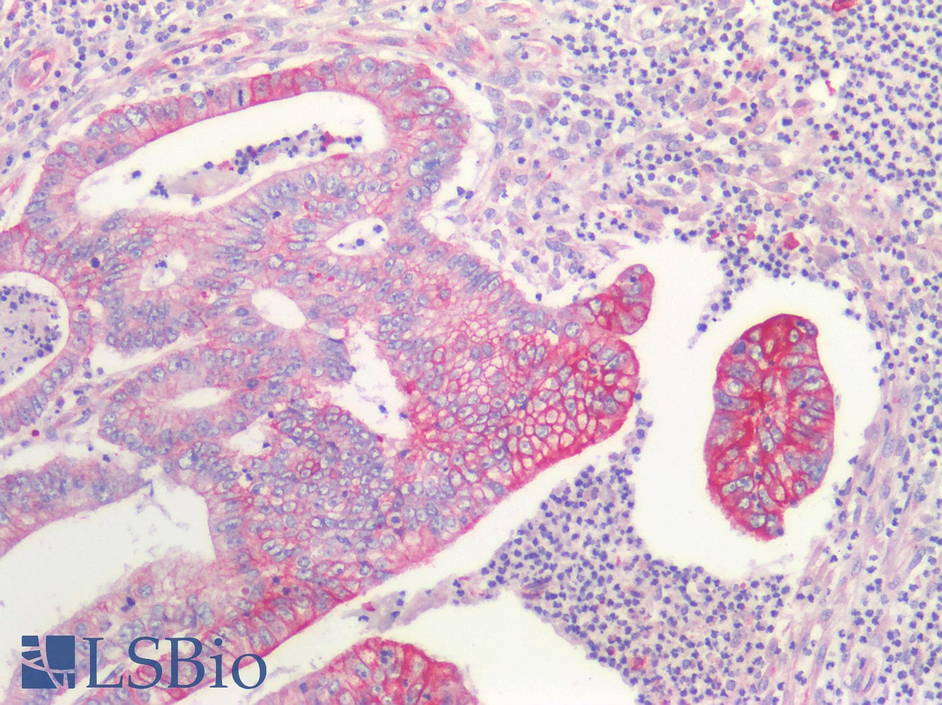 PathPlus™ Polyclonal Rabbit anti-Human KRT20 / CK20 / Cytokeratin 20 Antibody (IHC)