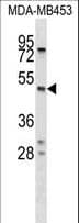 SERPINA5 / PCI Antibody (aa5-33)