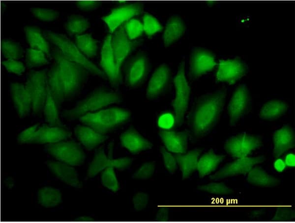 PathPlus™ ENO1 / Alpha Enolase Antibody (clone 8G8)