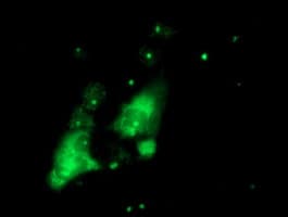 PGAM2 Antibody (clone OTI1E12)