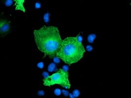 CCM2 / Malcavernin Antibody (clone OTI4F5)
