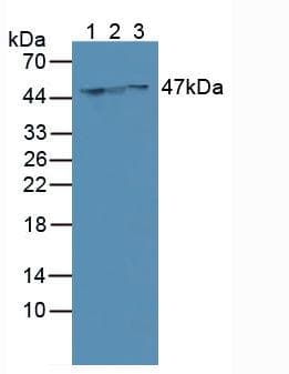 KRT18 / CK18 / Cytokeratin 18 Antibody (aa72-380)