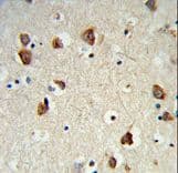 RPS6KB2 / S6K2 Antibody