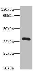 Polyclonal Rabbit anti-Human NTM / Neurotrimin Antibody (IHC, WB)