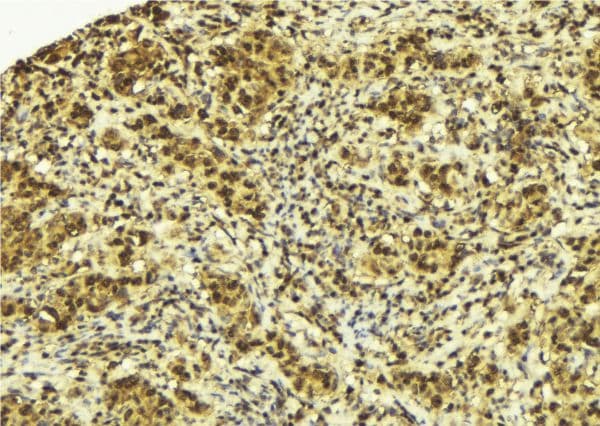 SPOP Antibody