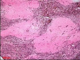 Fibroblasts Antibody (clone ER-TR7)