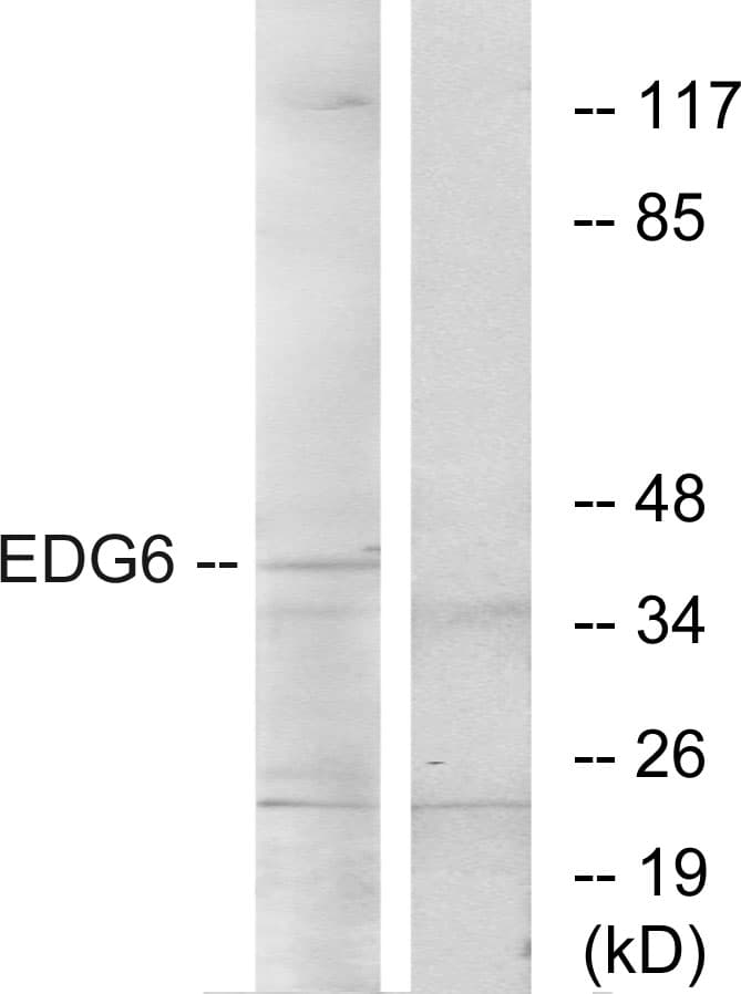 Polyclonal Rabbit anti-Human S1PR4 / SIP4 / EDG6 Antibody (aa326-375, IF, WB)