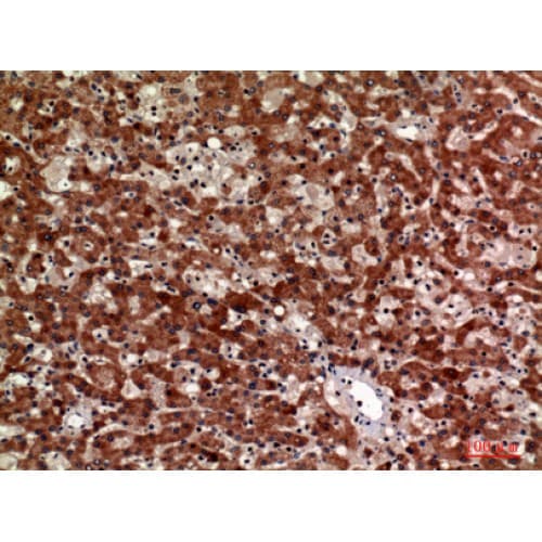 Polyclonal Rabbit anti-Human CD63 Antibody (121-170 aa, Internal, IHC, WB)