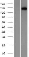 DSC1 / Desmocollin 1 Protein (Over-Expression Lysate Myc-DDK (Flag))