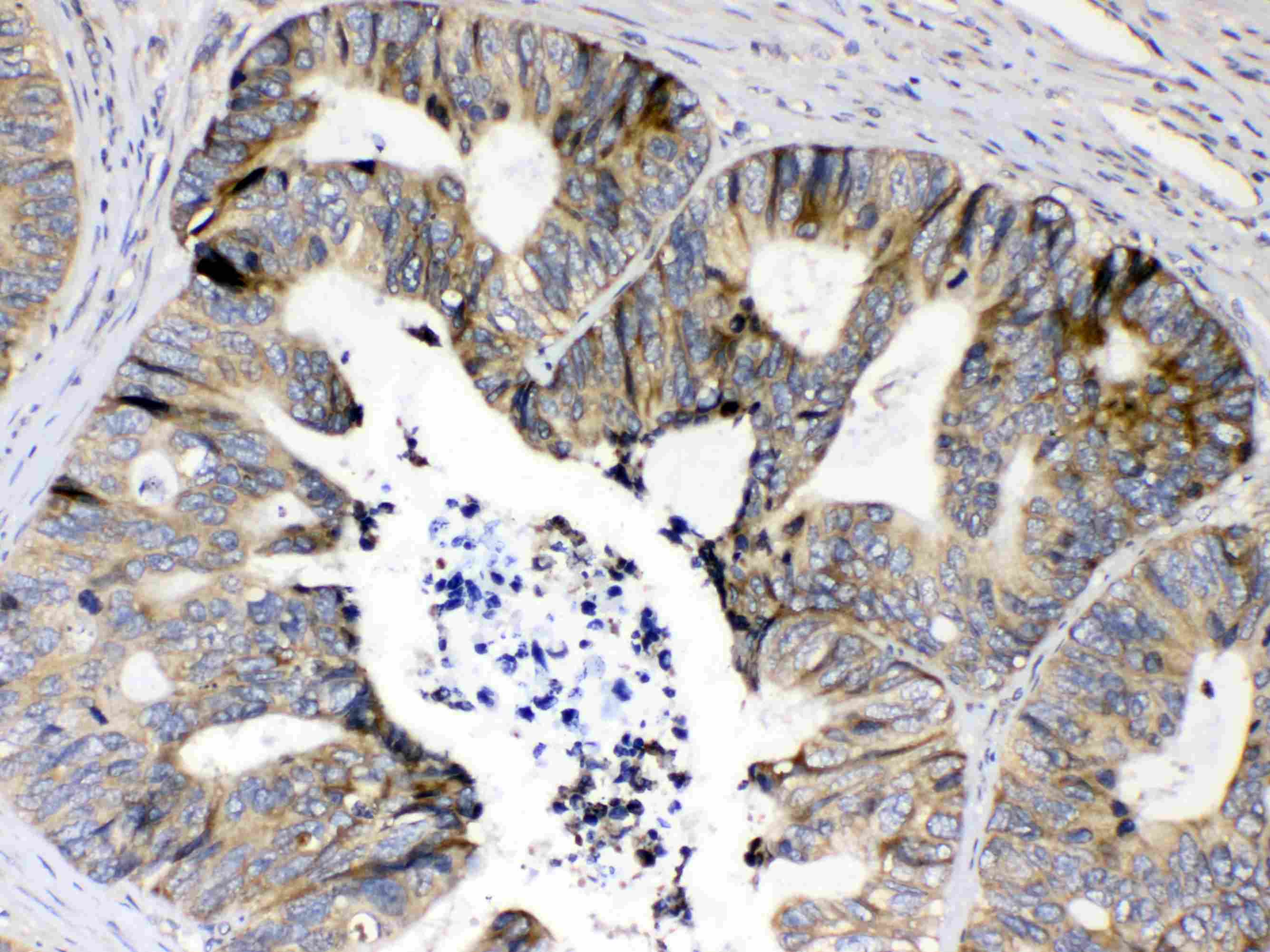 Polyclonal Rabbit anti-Human RPS6 / Ribosomal Protein S6 Antibody (IHC, WB)