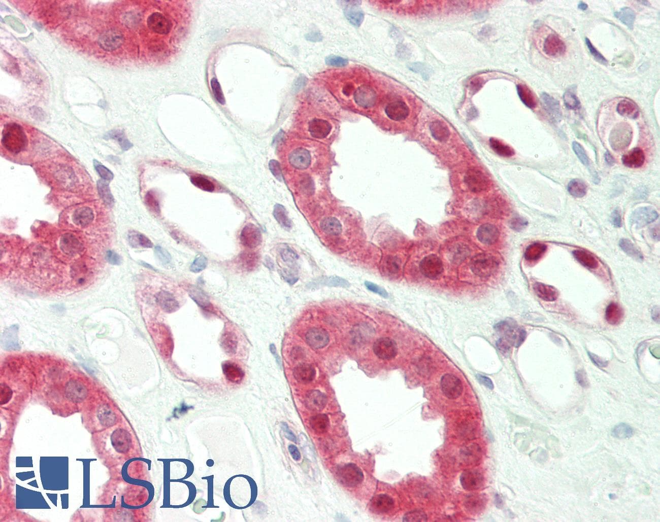 GSR / Glutathione Reductase Antibody (aa182-231)