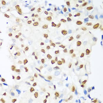 HDAC1 Antibody