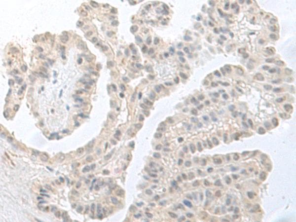 RPS27L Antibody