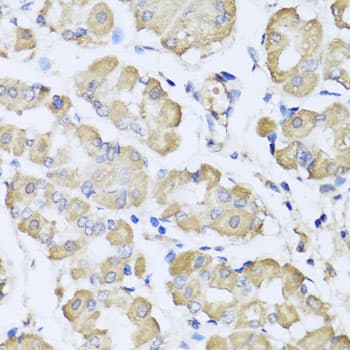 Polyclonal Rabbit anti-Human L2HGDH Antibody (IHC, WB)