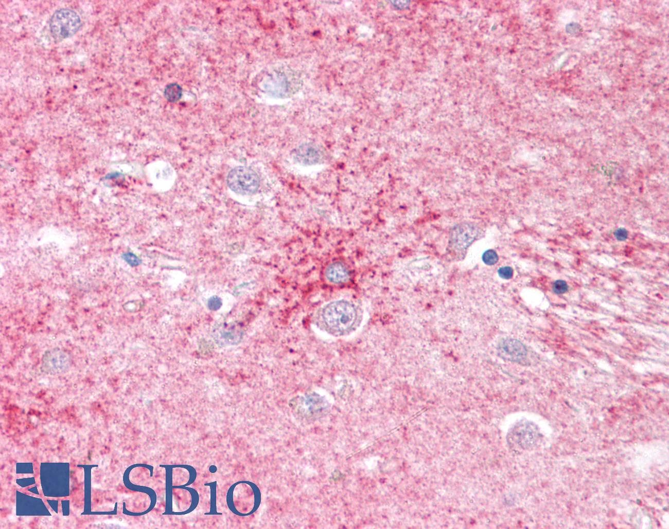 IHC-plus™ SLC1A4 / ASCT1 Antibody (Internal)