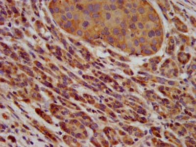 PAFAH1B3 Antibody
