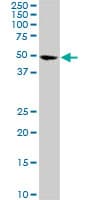 Monoclonal Mouse anti-Human CDK8 Antibody (clone 6H5, WB)
