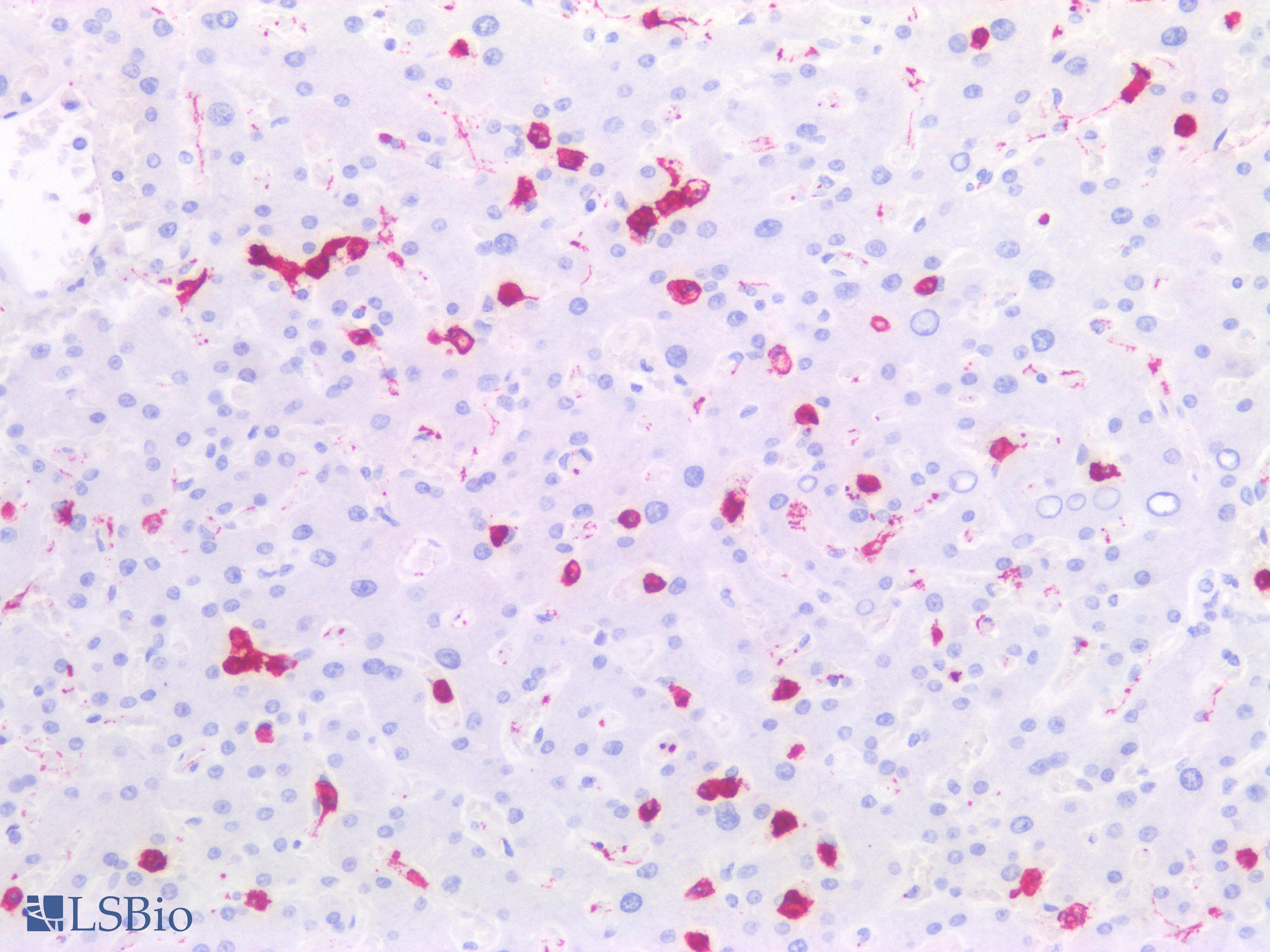 PathPlus™ FUT4 / CD15 Antibody (clone MMA)
