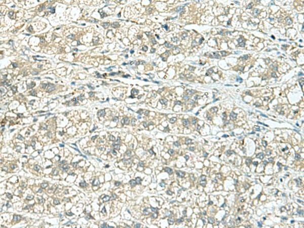 FAM46C Antibody