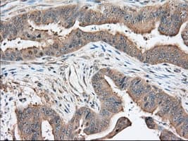KHK / Ketohexokinase Antibody (clone OTI4E9)