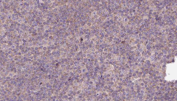 Polyclonal Rabbit anti-Human MYO18A Antibody (IHC, IF, WB)