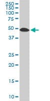 STK38 Antibody (clone 3A5)