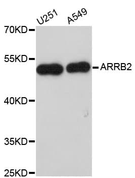 Polyclonal Rabbit anti-Human ARRB2 / Beta Arrestin 2 Antibody (IHC, IF, WB)