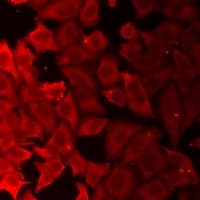AK1 / Adenylate Kinase 1 Antibody