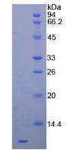 Human SDF1 / CXCL12 Protein (Recombinant His)