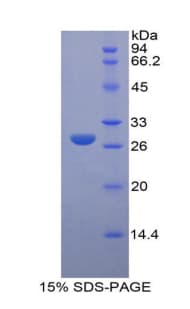Mouse LOXL3 Protein (Recombinant His-T7)