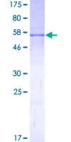 Human CDK6 Protein (Recombinant GST)