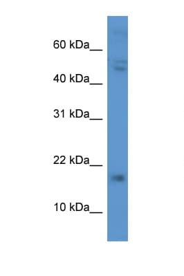 CGB / hCG Beta Antibody (C-Terminus)
