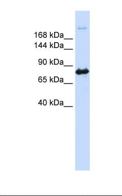 CAD Antibody (N-Terminus)