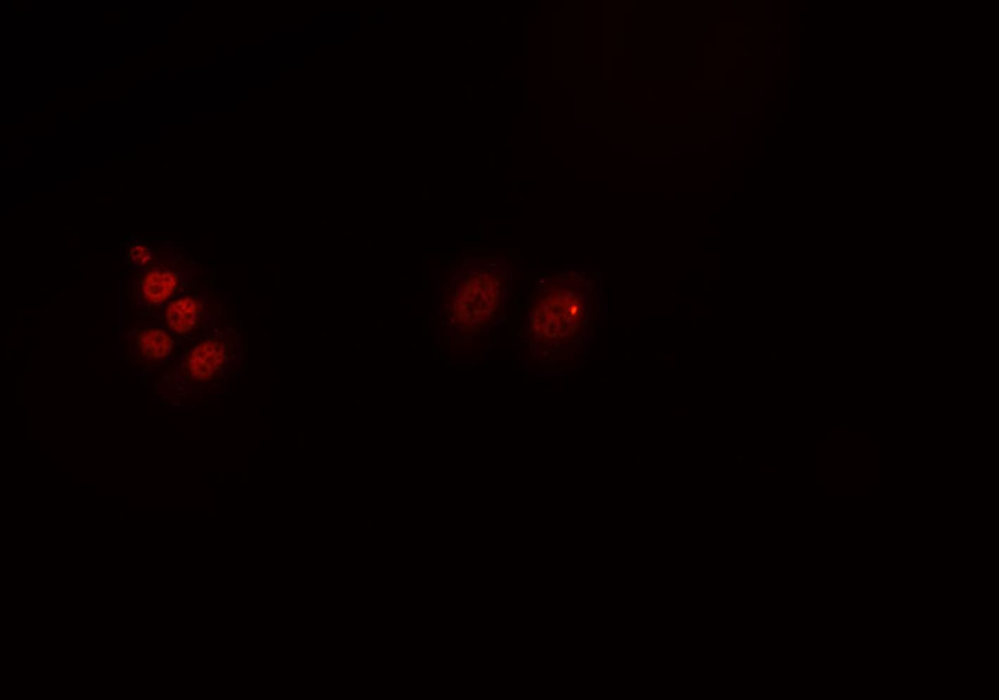 Polyclonal Rabbit anti-Human BDNF Antibody (IHC, IF, WB)