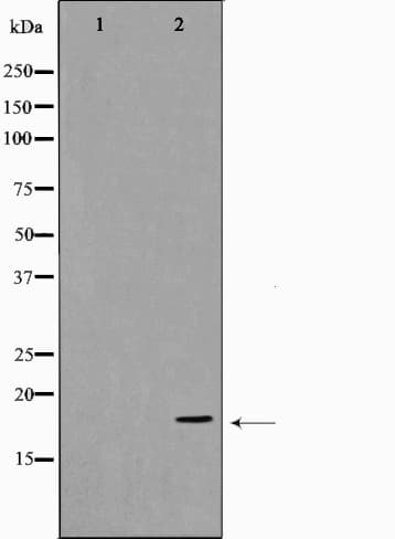 Polyclonal Rabbit anti-Human SNCA / Alpha-Synuclein Antibody (WB)