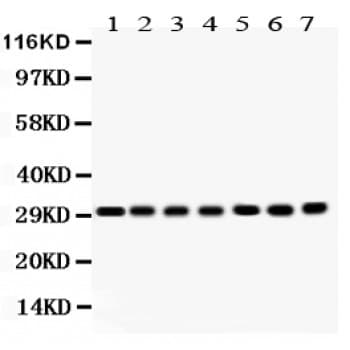 COMT Antibody (aa52-271)