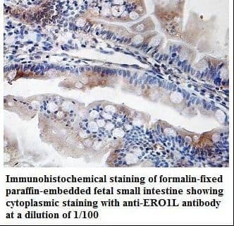 Polyclonal Rabbit anti-Human ERO1A / ERO1L Antibody (aa37-189, IHC, WB)