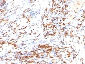CDKN1B / p27 Kip1 Antibody (clone DCS-72.F6 + KIP1/769, Azide-free, BSA-free)