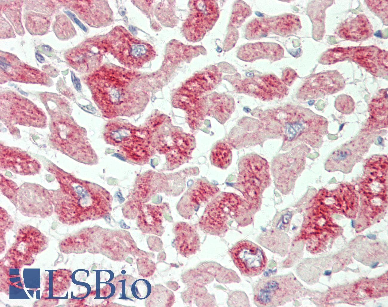 IHC-plus™ MTIF2 Antibody (aa138-167)
