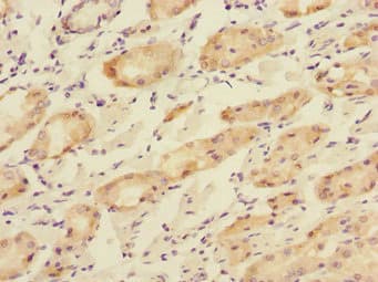 Polyclonal Rabbit anti-Human TOB2 Antibody (IHC)