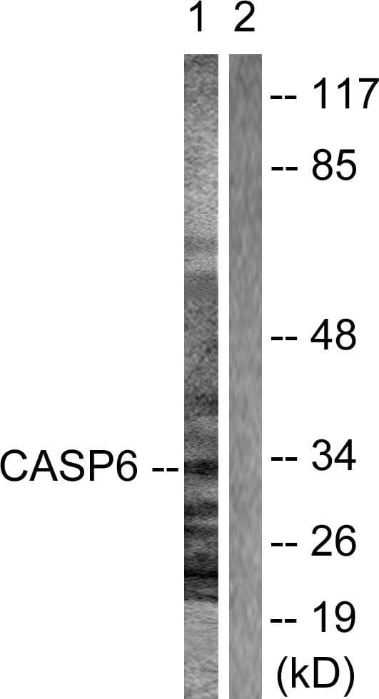 CASP6 / Caspase 6 Antibody (p257)