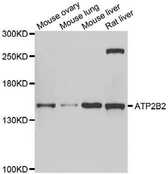 ATP2B2 / PMCA2 Antibody