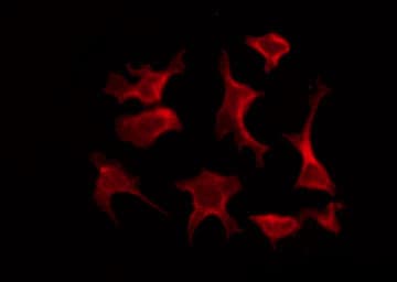 Polyclonal Rabbit anti-Human p14ARF / CDKN2A Antibody (IHC, IF, WB)