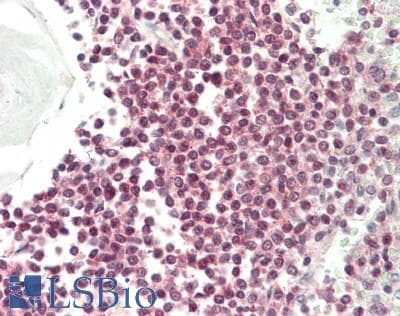 IHC-plus™ Polyclonal Rabbit anti-Human RAD23A / HHR23A Antibody (aa200-250, IHC, WB)