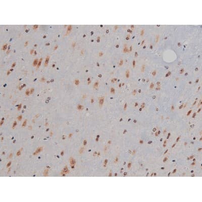IGF1R / IGF1 Receptor Antibody (phospho-Tyr1346)
