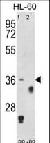 Polyclonal Rabbit anti-Human TNFRSF14 / CD270 / HVEM Antibody (aa210-236, IHC, WB)